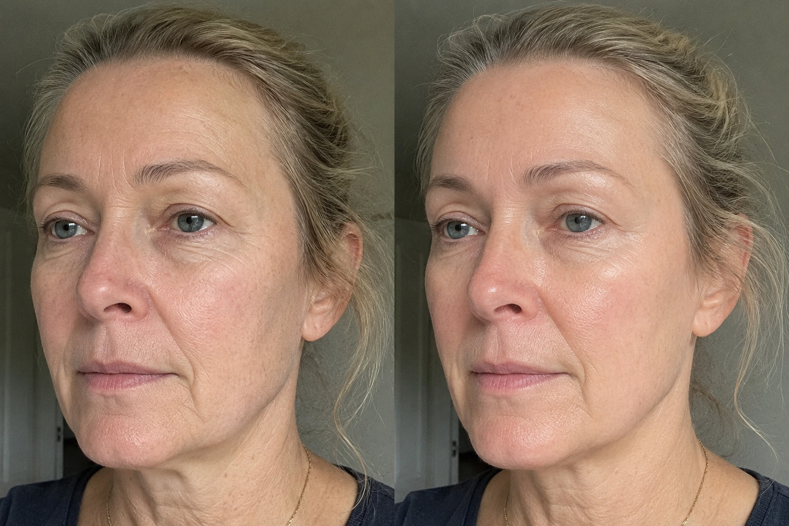 Day 1 versus Day 28, same light, no filter